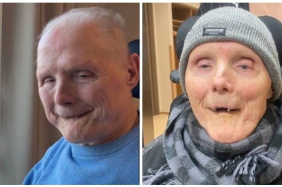 Fylkeslegen: Trondheim kommune brøt loven da Alf Ingar (67) døde på sykehjem